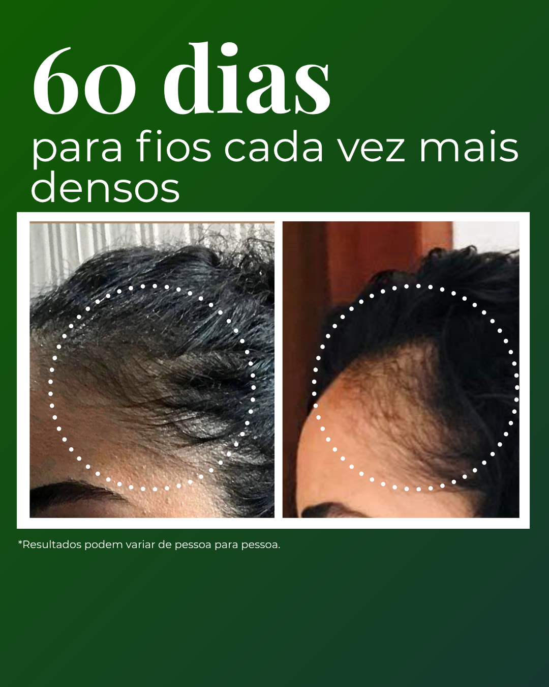 Tônico Capilar Salut